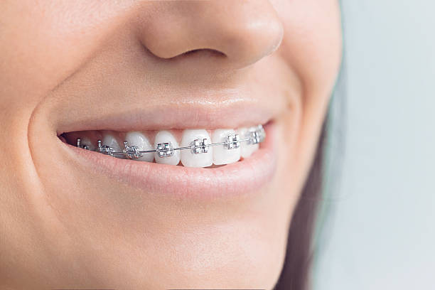 Advanced Technology for Better Dental Care in Charlotte, NC